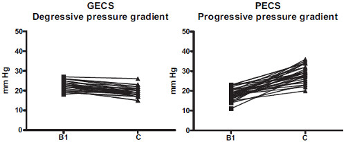 Degressiver vs. progressiver Druckverlauf bei Kompressionsstulpen