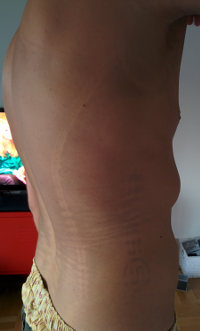 Skins Abdruck des Skins Logos