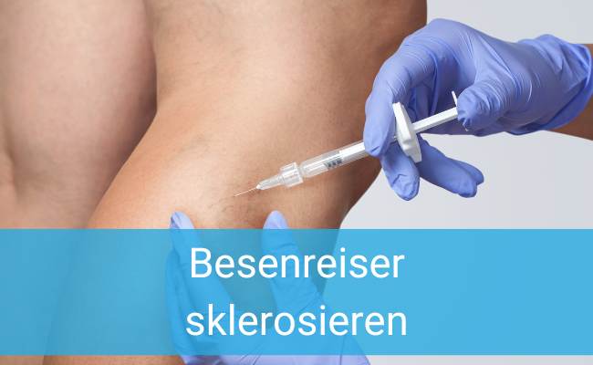 Besenreiser Sklerosierung