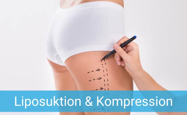 Liposuktion und Kompression