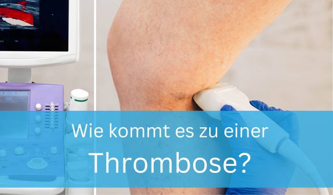 Wann entsteht eine Thrombose?